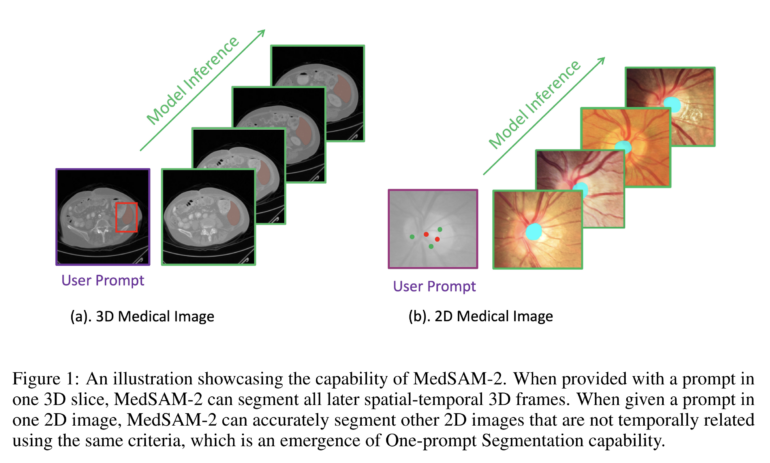 MedSAM-2-overview-770x463.png