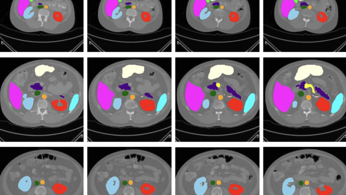 MedSAM-2-title-1-1200x675.png